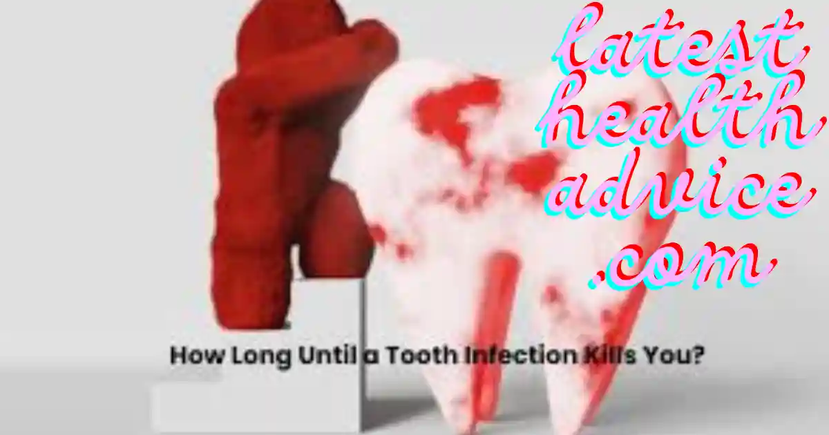 How Long Until A Tooth Infection kills you