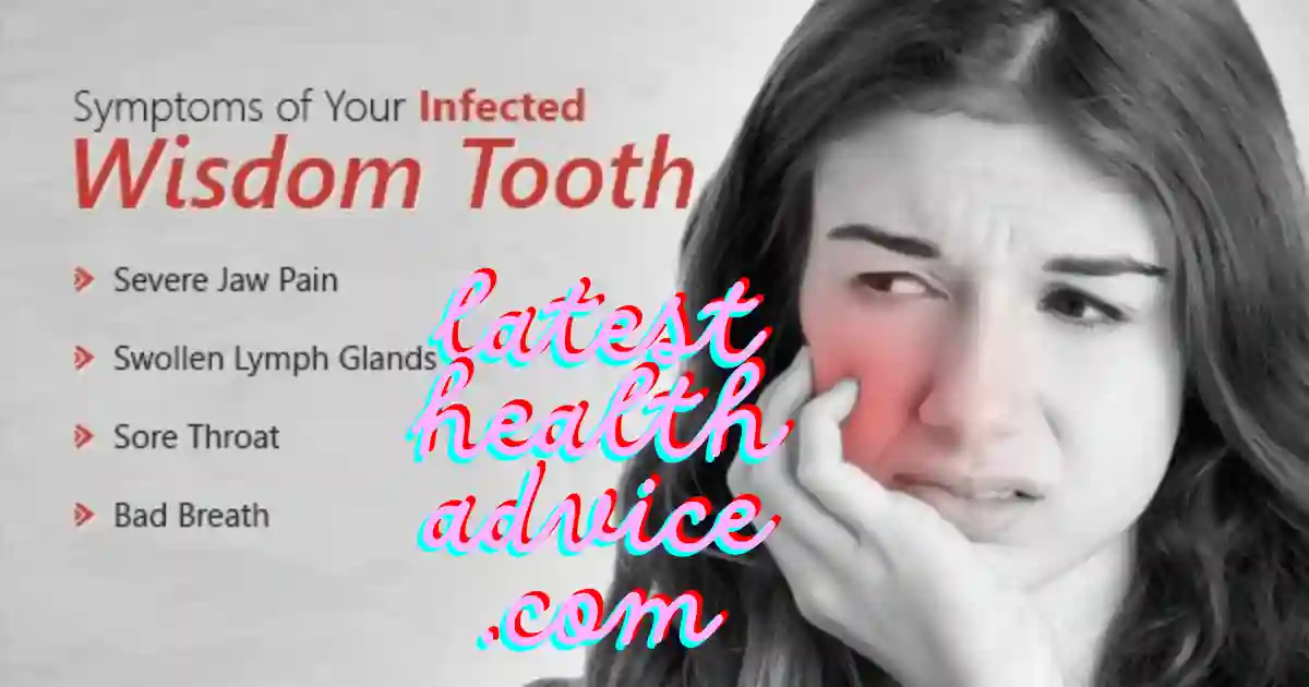 Signs of Wisdom Teeth Infection